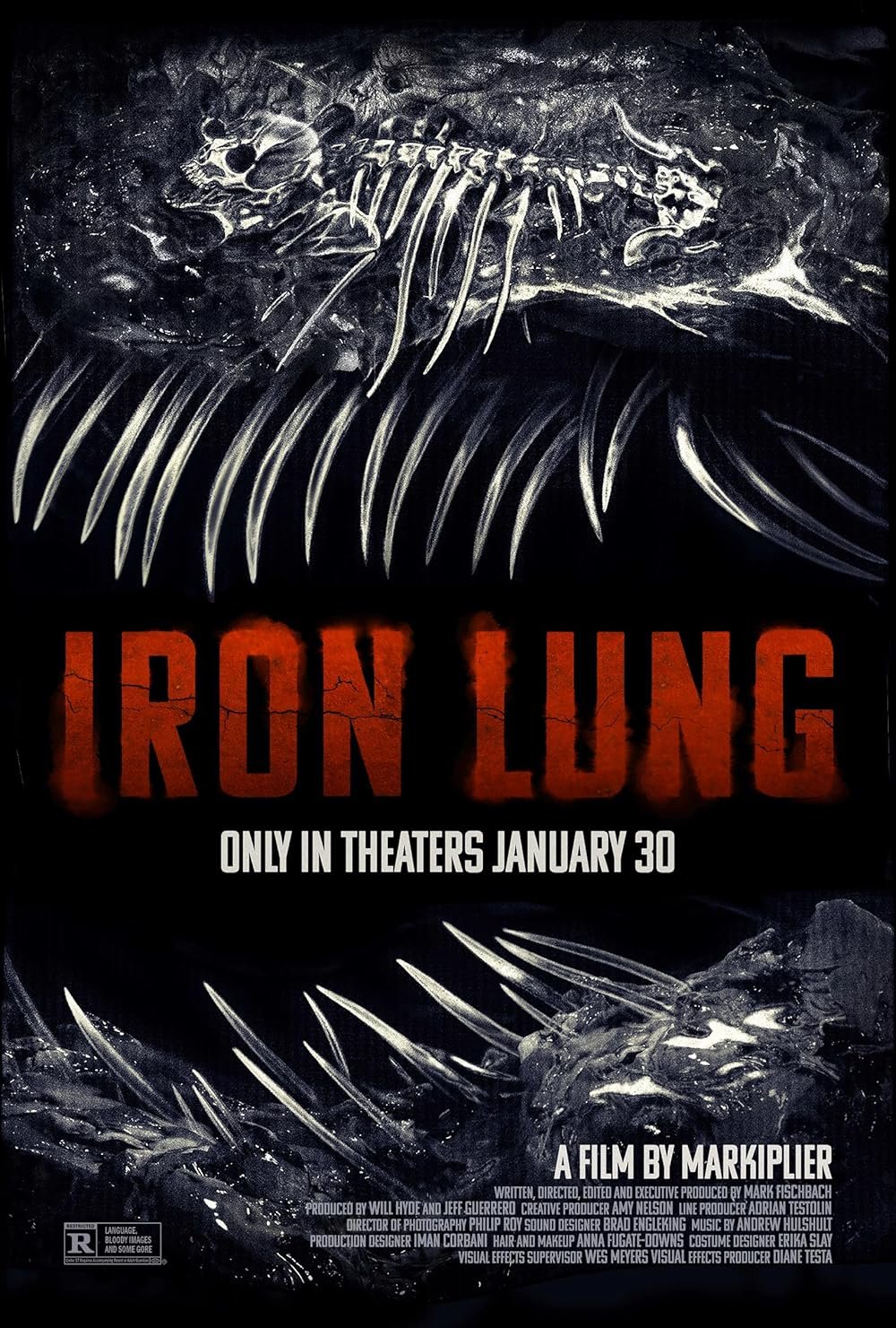 iron lung